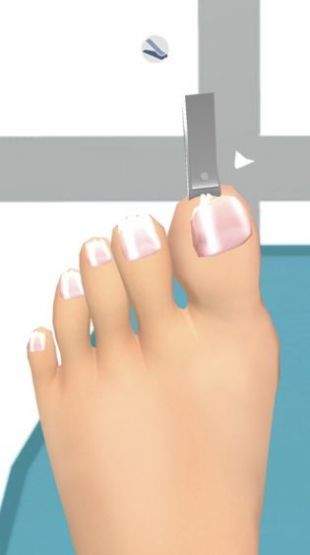 老板修个脚甲沟炎